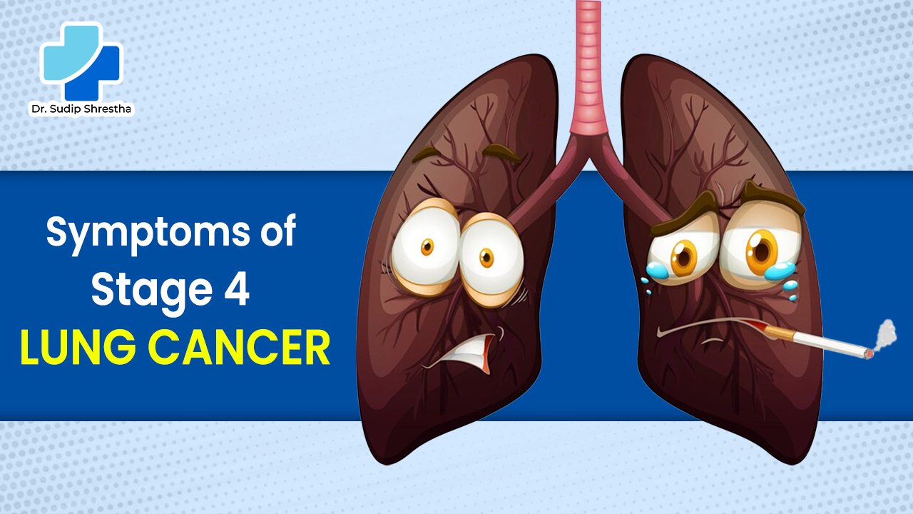 lung cancer stage 4 no symptoms