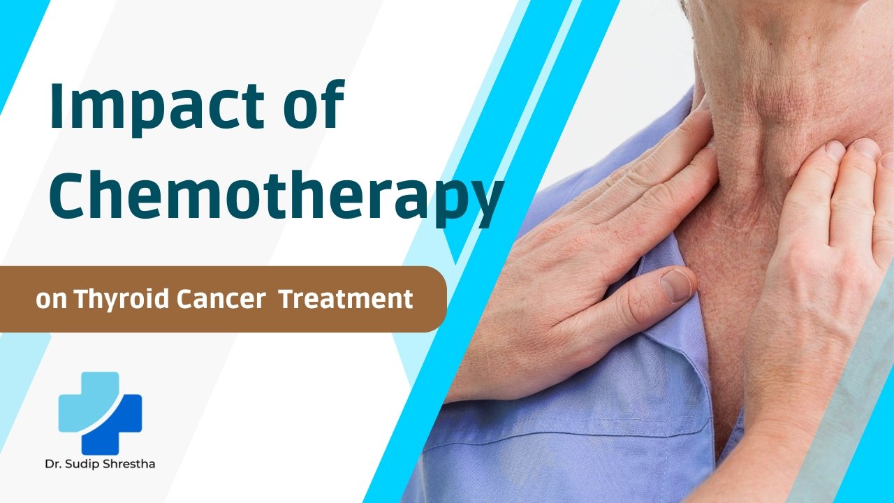 Impact of chemotherapy on thyroid cancer treatment