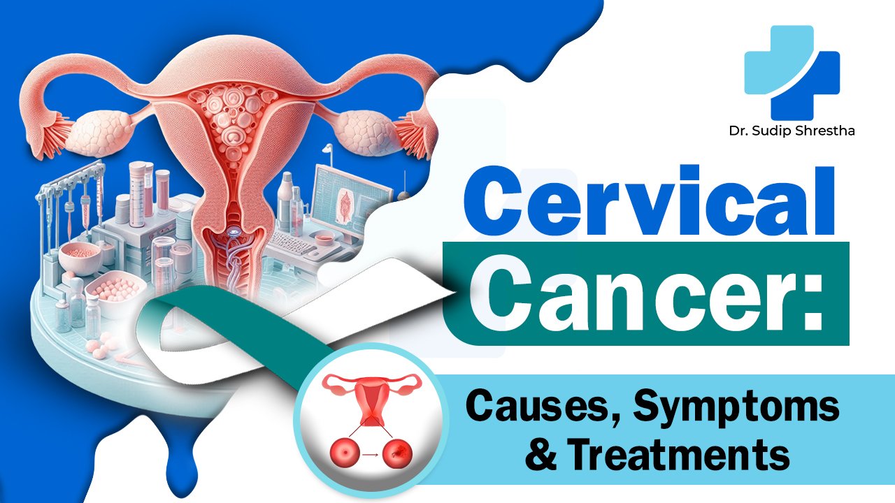 Cervical Cancer