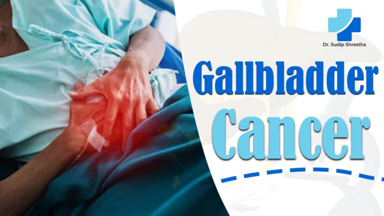 Gallbladder Cancer