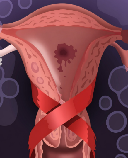 Cervical Cancer Awareness Month