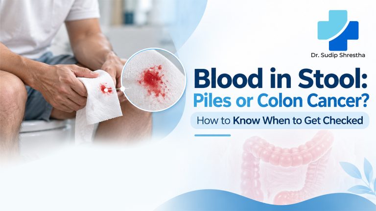 blood in stool