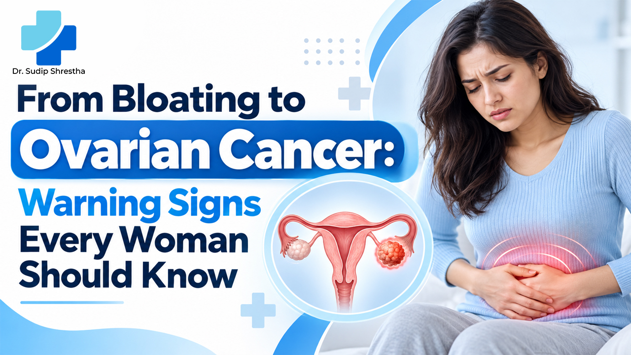 Ovarian Cancer